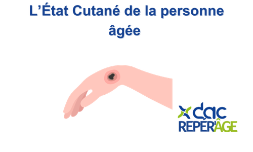 L’état cutané (1).png